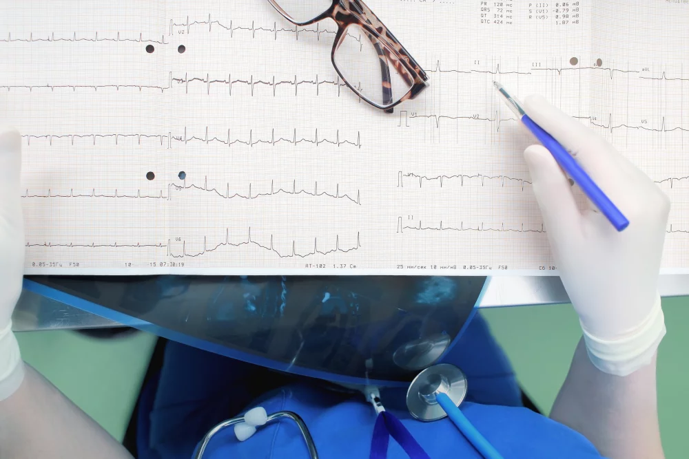 Szkoła diagnostyki EKG: Moduł 2. Dekalog opisu EKG